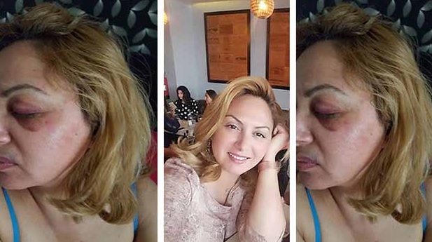 هل خادعت هذه المرأة الرأي العام بادّعاء أن أمنيين عنّفوها وشتموها وتحرّشوا بها و " سرقوها " ؟
